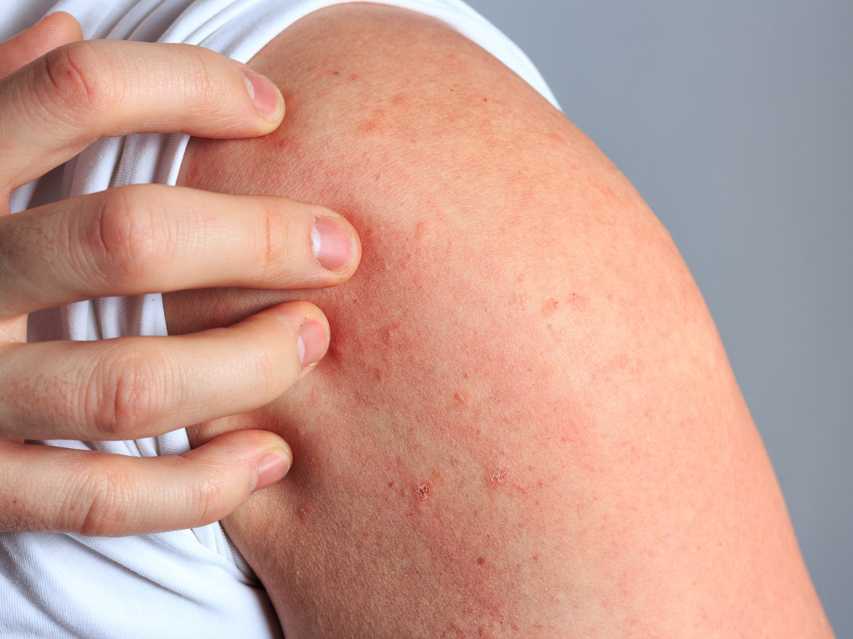 chirurgiens au bloc chirurgie colo rectale